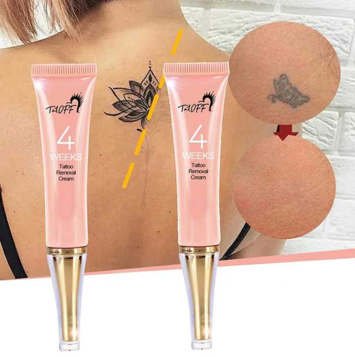 6 Best Tattoo Removal Creams That Works Fast to Remove Tattoos Tattoo